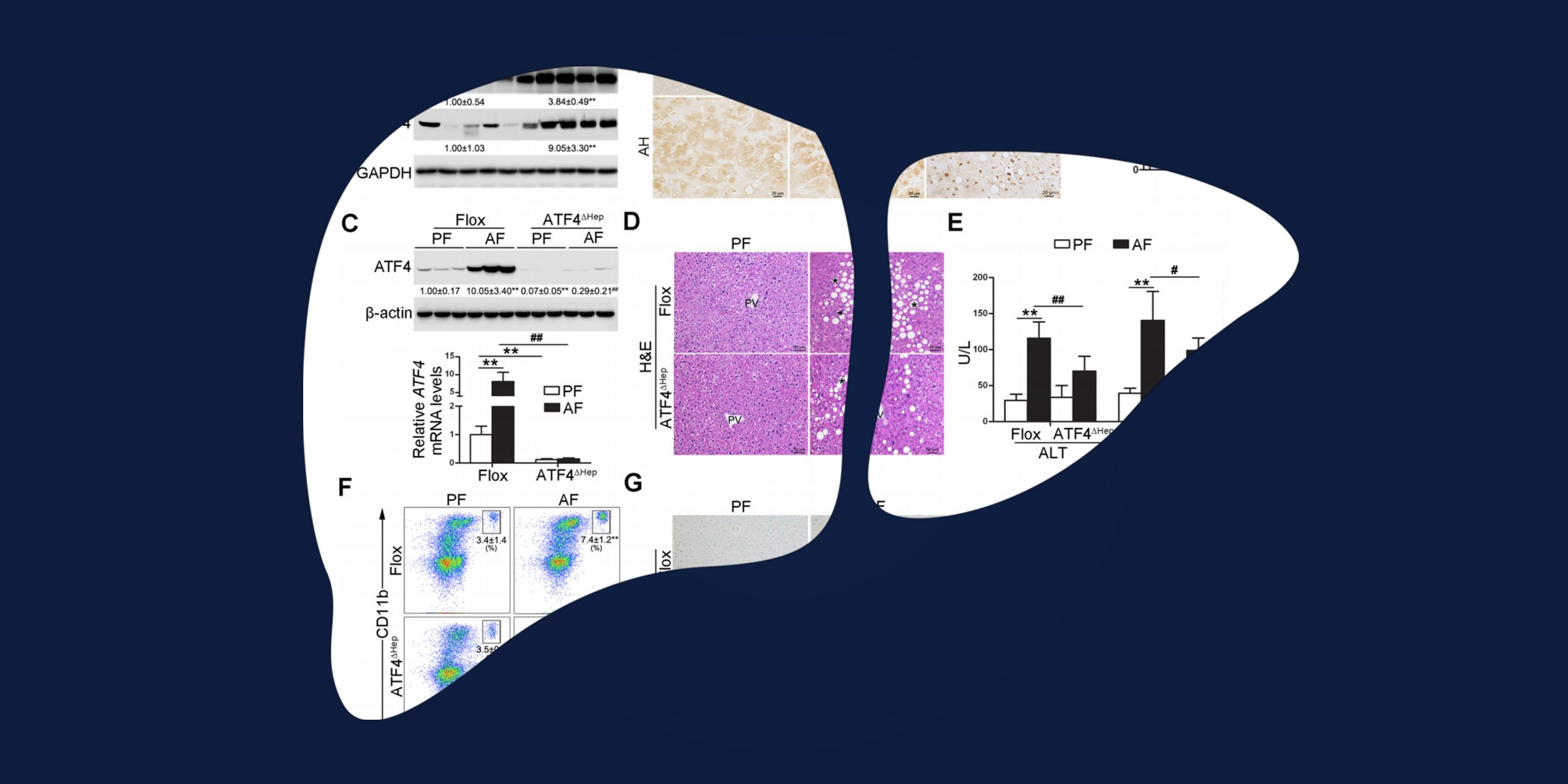 Featured Image for How targeting the ATF4 gene could help us fight alcoholic liver disease